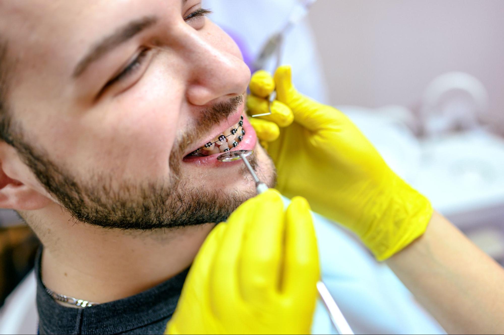 orthodontist baytown tx