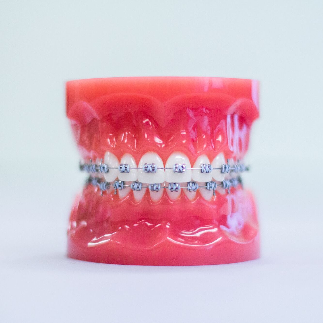 braces treatment baytown tx