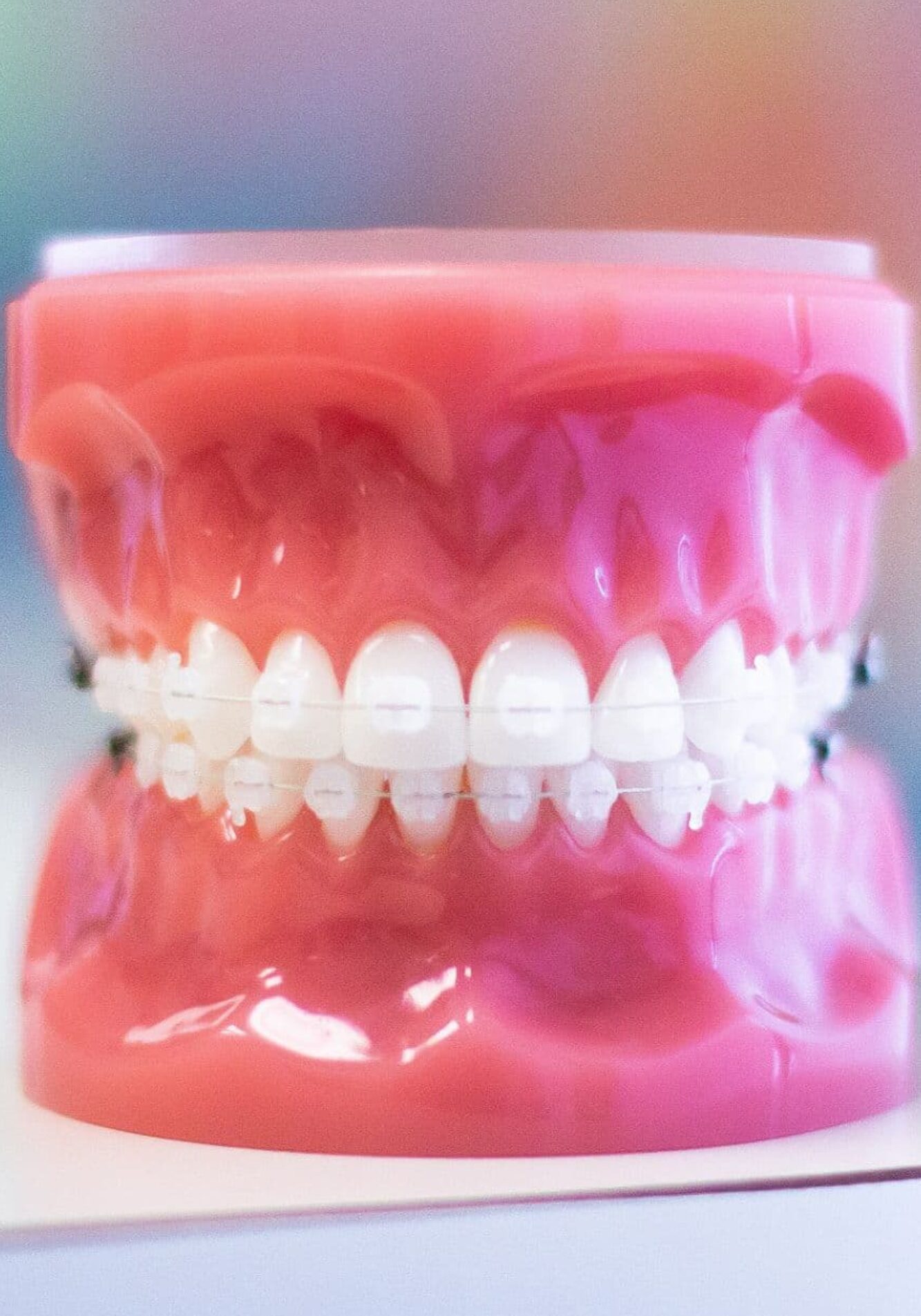 clear braces